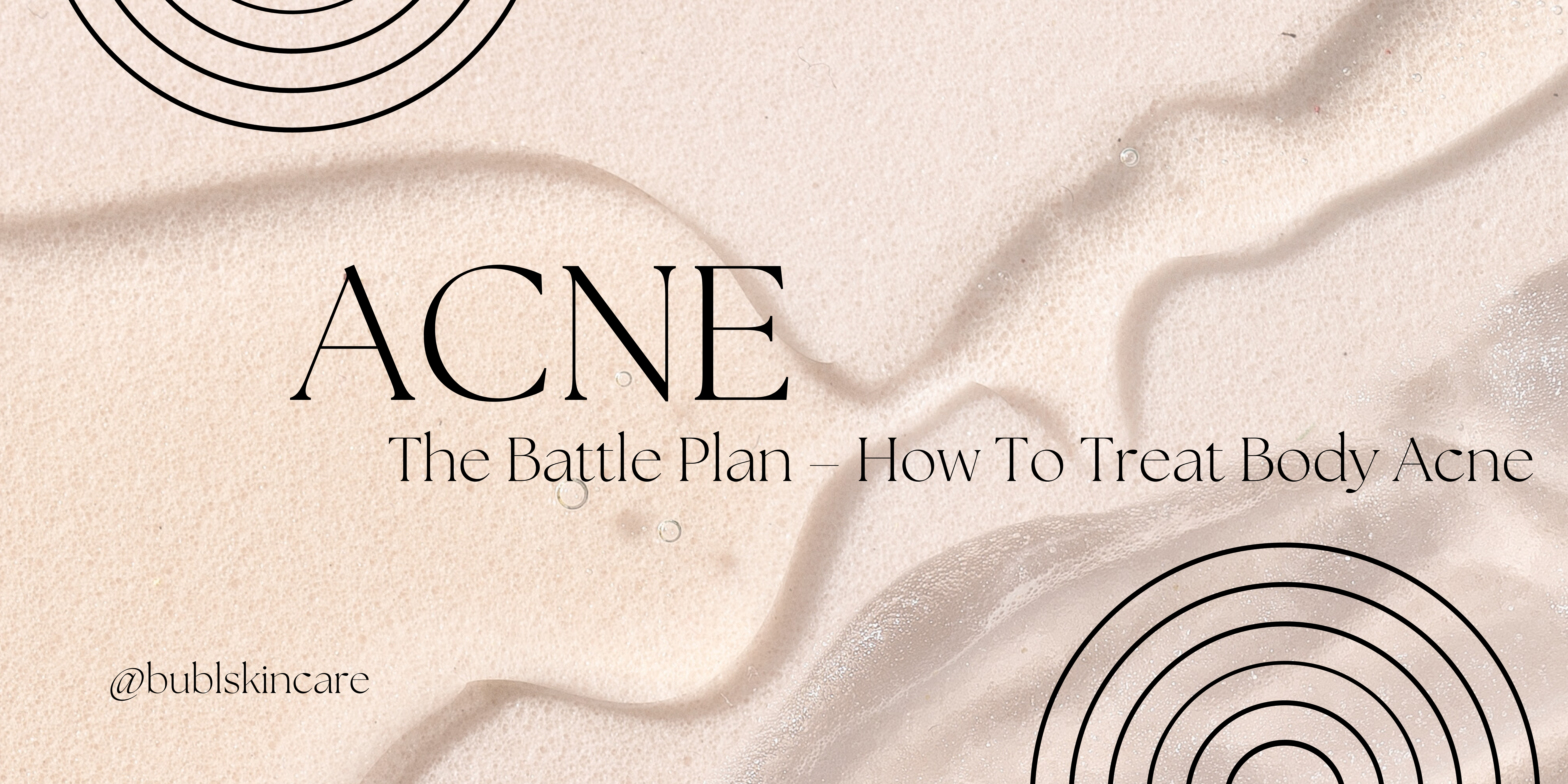 Banish Acne Your Ultimate Guide to Prevention and Treatment Strategies - www.bublproducts.com